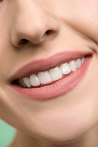 teeth-whitening-adelaide